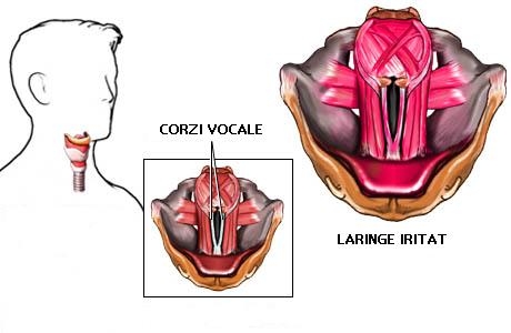 imagini boli respiratorii